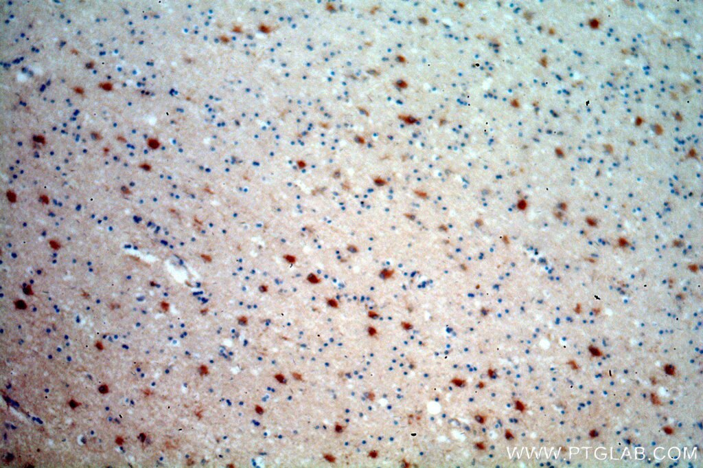 Immunohistochemistry (IHC) staining of human brain tissue using STXBP1 Polyclonal antibody (20562-1-AP)