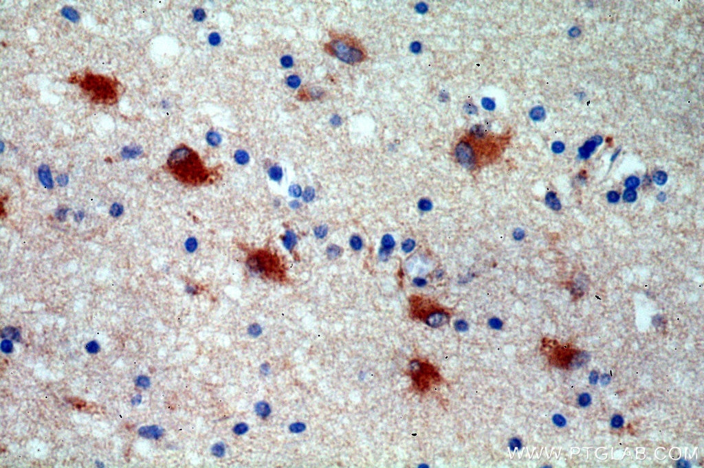 Immunohistochemistry (IHC) staining of human brain tissue using STXBP1 Polyclonal antibody (20562-1-AP)