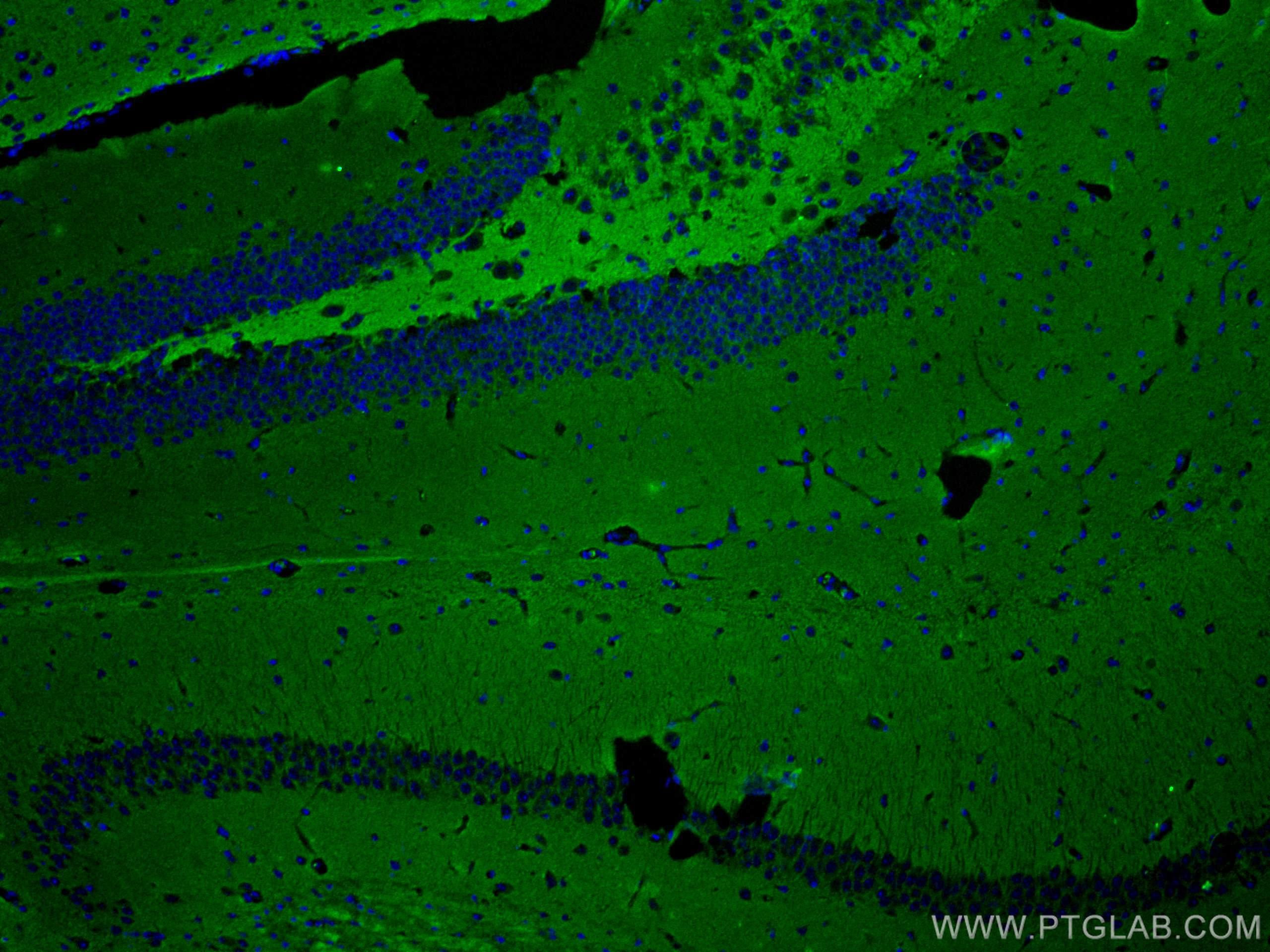 Immunofluorescence (IF) / fluorescent staining of mouse brain tissue using STXBP1 Monoclonal antibody (67137-1-Ig)