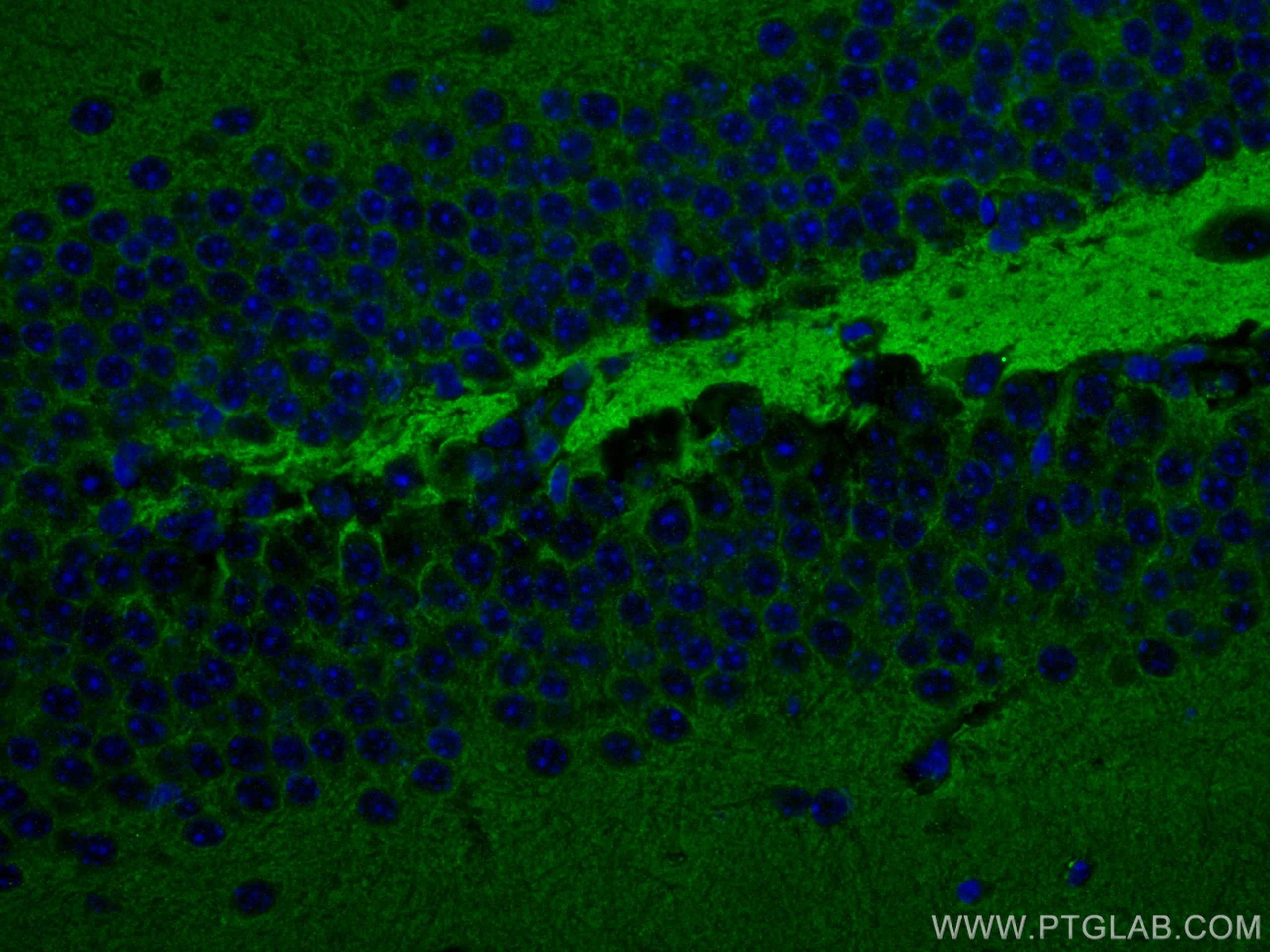 Immunofluorescence (IF) / fluorescent staining of mouse brain tissue using STXBP1 Monoclonal antibody (67137-1-Ig)