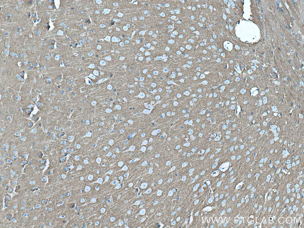 IHC staining of mouse brain using 67137-1-Ig