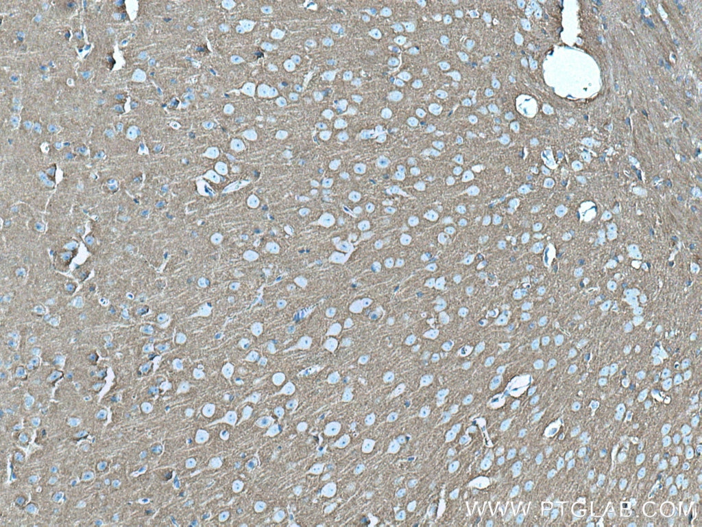 Immunohistochemistry (IHC) staining of mouse brain tissue using STXBP1 Monoclonal antibody (67137-1-Ig)