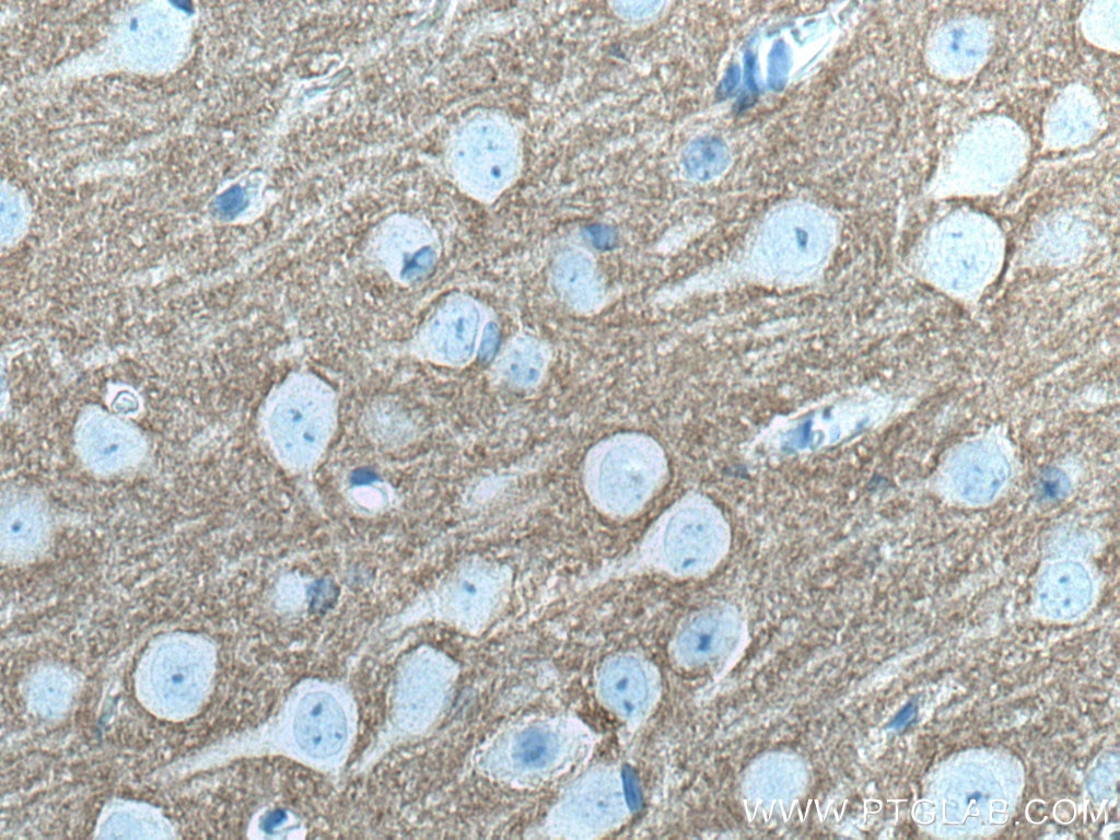 Immunohistochemistry (IHC) staining of mouse brain tissue using STXBP1 Monoclonal antibody (67137-1-Ig)