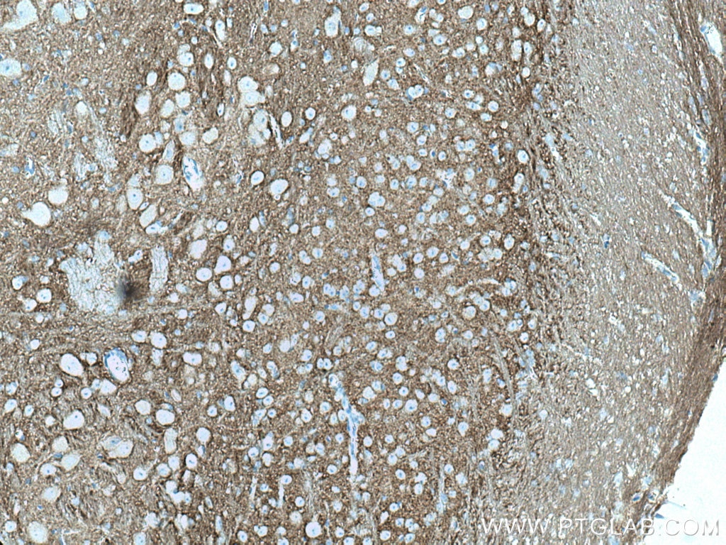 Immunohistochemistry (IHC) staining of mouse cerebellum tissue using STXBP1 Monoclonal antibody (67137-1-Ig)