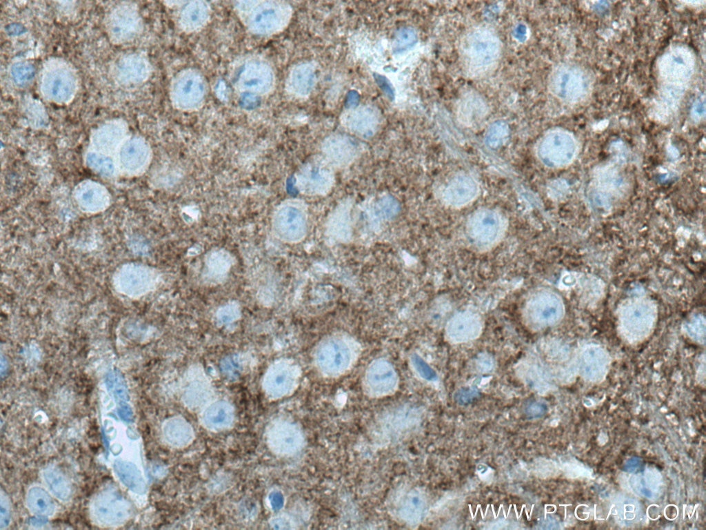Immunohistochemistry (IHC) staining of mouse cerebellum tissue using STXBP1 Monoclonal antibody (67137-1-Ig)