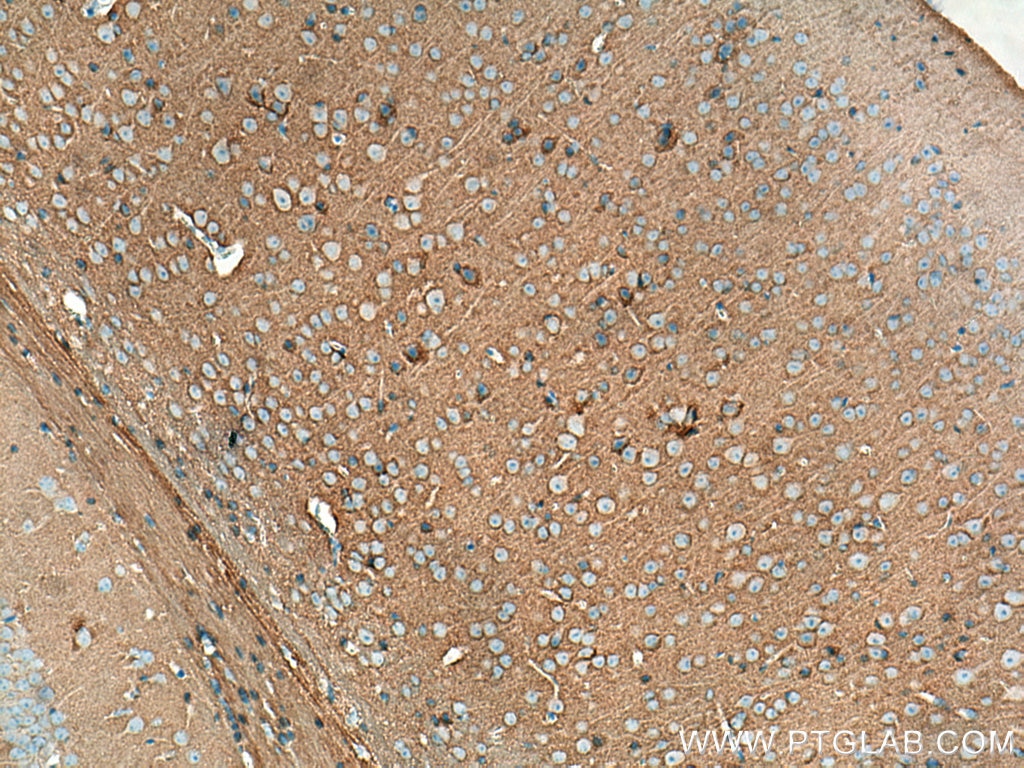 Immunohistochemistry (IHC) staining of mouse brain tissue using Biotin-conjugated STXBP1 Polyclonal antibody (Biotin-11459)