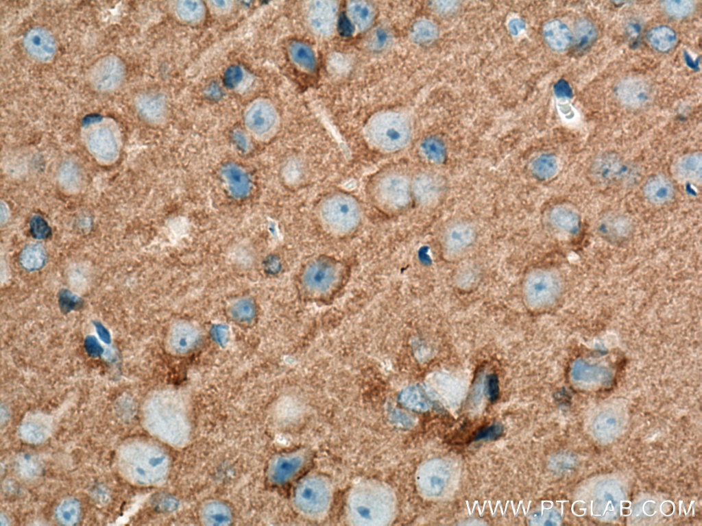 Immunohistochemistry (IHC) staining of mouse brain tissue using Biotin-conjugated STXBP1 Polyclonal antibody (Biotin-11459)