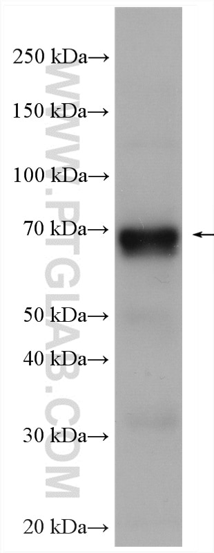 Western Blot (WB) analysis of Y79 cells using Biotin-conjugated STXBP1 Polyclonal antibody (Biotin-11459)