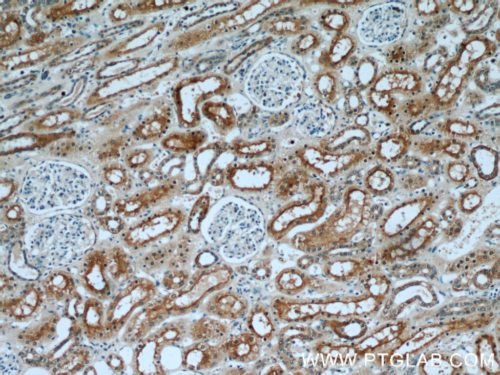 Immunohistochemistry (IHC) staining of human kidney tissue using STXBP2 Polyclonal antibody (15312-1-AP)