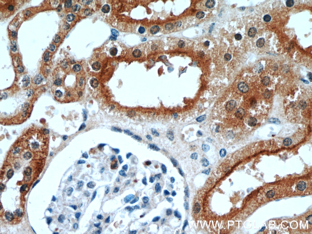 Immunohistochemistry (IHC) staining of human kidney tissue using STXBP2 Polyclonal antibody (15312-1-AP)