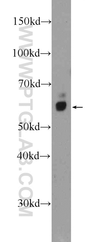 Western Blot (WB) analysis of rat kidney tissue using STXBP2 Polyclonal antibody (15312-1-AP)