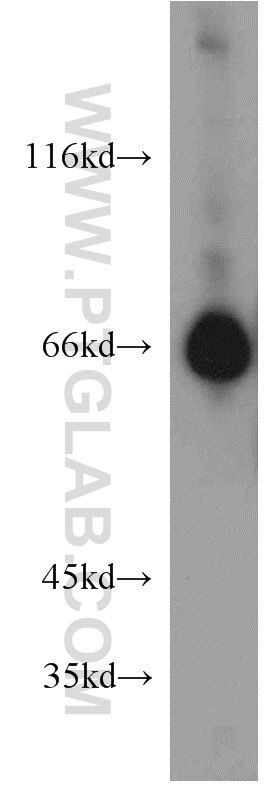 Western Blot (WB) analysis of mouse brain tissue using STXBP2 Polyclonal antibody (15312-1-AP)