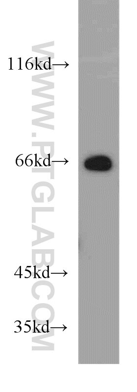 Western Blot (WB) analysis of mouse kidney tissue using STXBP2 Polyclonal antibody (15312-1-AP)