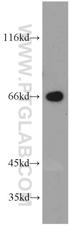 Western Blot (WB) analysis of Jurkat cells using STXBP2 Polyclonal antibody (15312-1-AP)