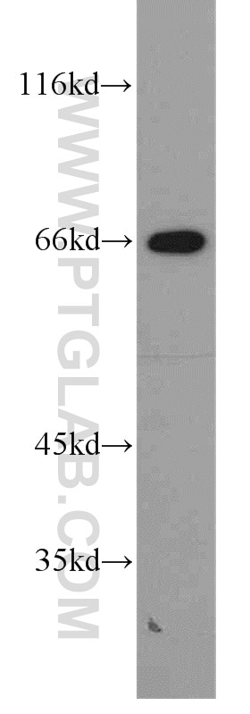 Western Blot (WB) analysis of K-562 cells using STXBP2 Polyclonal antibody (15312-1-AP)