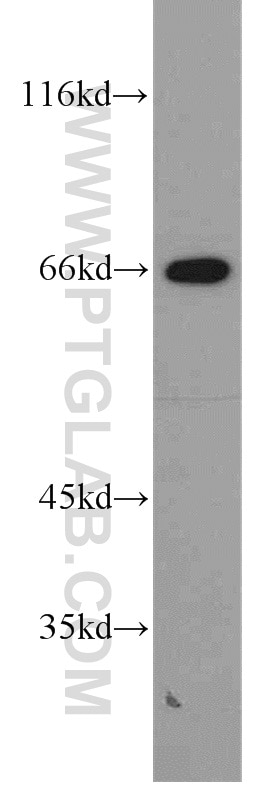 WB analysis of K-562 using 15312-1-AP