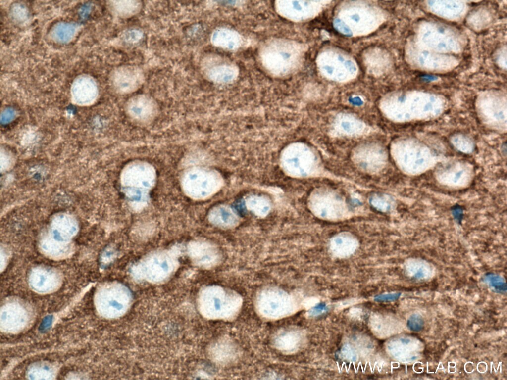 Immunohistochemistry (IHC) staining of mouse brain tissue using STXBP2 Monoclonal antibody (66238-1-Ig)