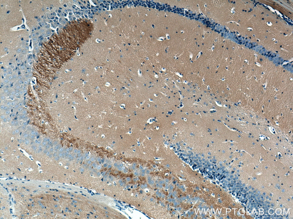 Immunohistochemistry (IHC) staining of mouse brain tissue using STXBP2 Monoclonal antibody (66238-1-Ig)