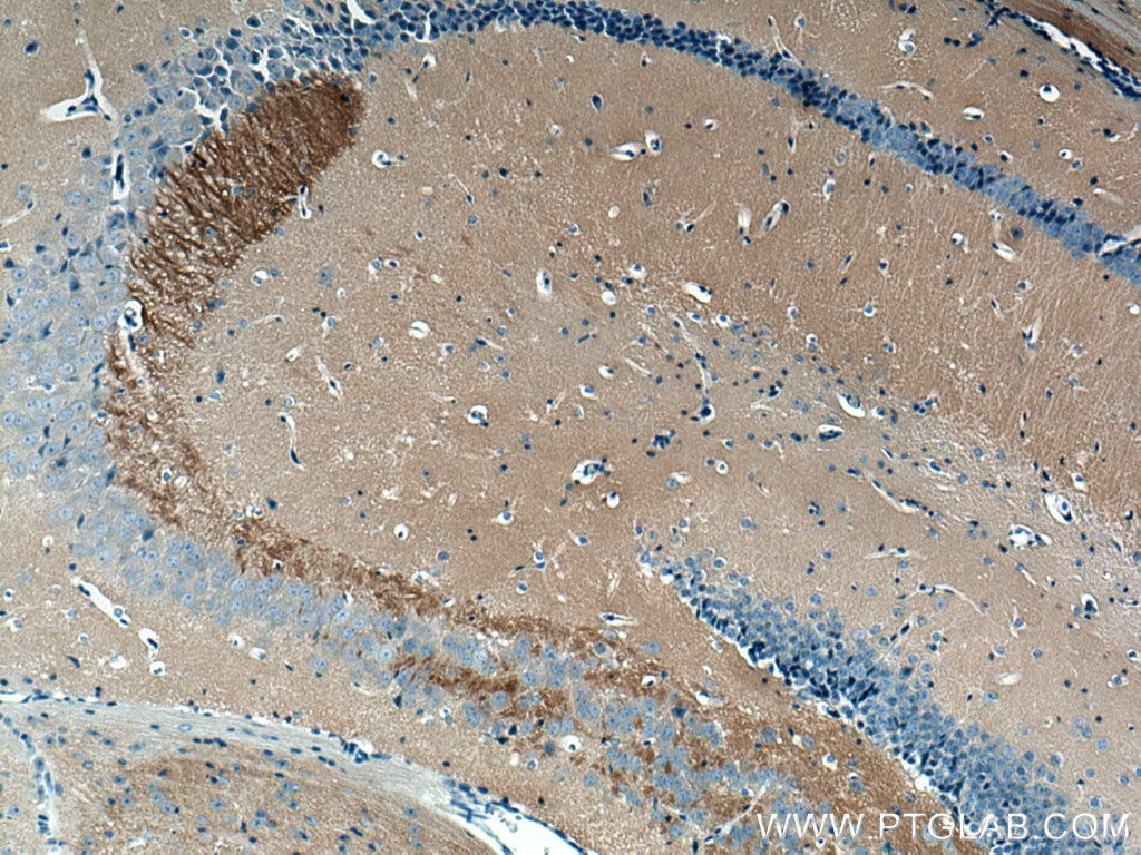 IHC staining of mouse brain using 66238-1-Ig