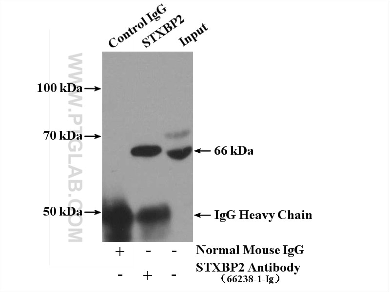 Immunoprecipitation (IP) experiment of K-562 cells using STXBP2 Monoclonal antibody (66238-1-Ig)