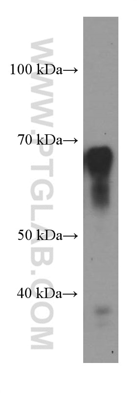 Western Blot (WB) analysis of fetal human brain tissue using STXBP2 Monoclonal antibody (66238-1-Ig)