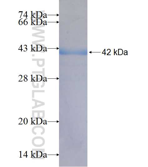 STXBP2 fusion protein Ag7640 SDS-PAGE