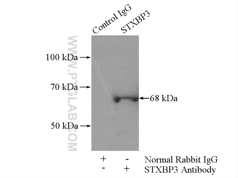 Immunoprecipitation (IP) experiment of K-562 cells using STXBP3 Polyclonal antibody (13764-1-AP)