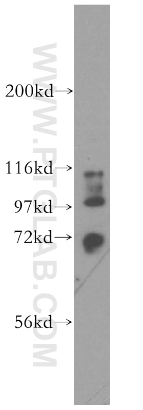 Western Blot (WB) analysis of HepG2 cells using STXBP3 Polyclonal antibody (13764-1-AP)