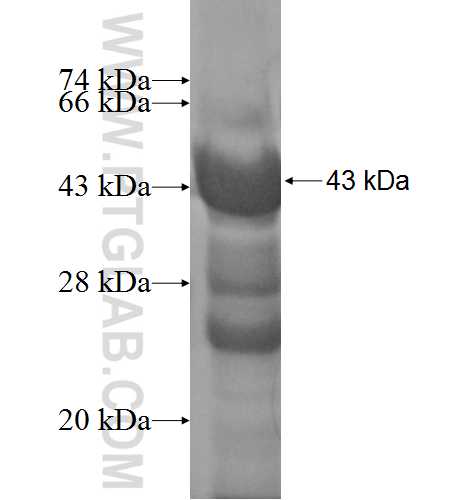 STXBP3 fusion protein Ag4738 SDS-PAGE