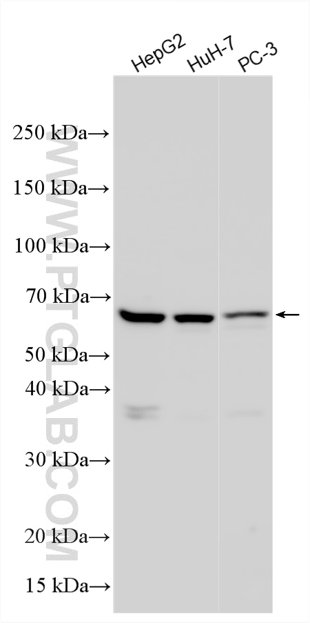 Western Blot (WB) analysis of various lysates using STXBP4 Polyclonal antibody (14231-1-AP)