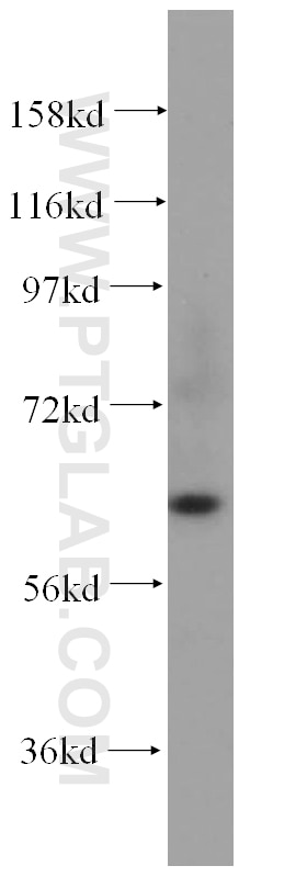 Western Blot (WB) analysis of human heart tissue using STXBP4 Polyclonal antibody (14231-1-AP)