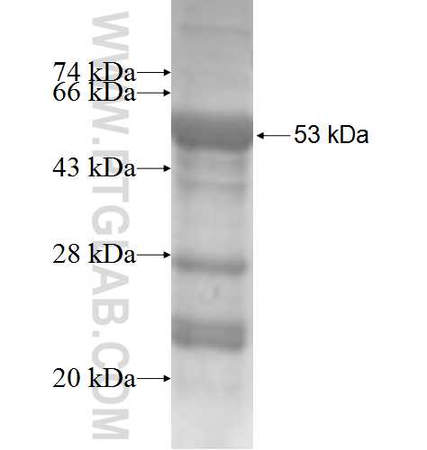 STXBP4 fusion protein Ag5471 SDS-PAGE