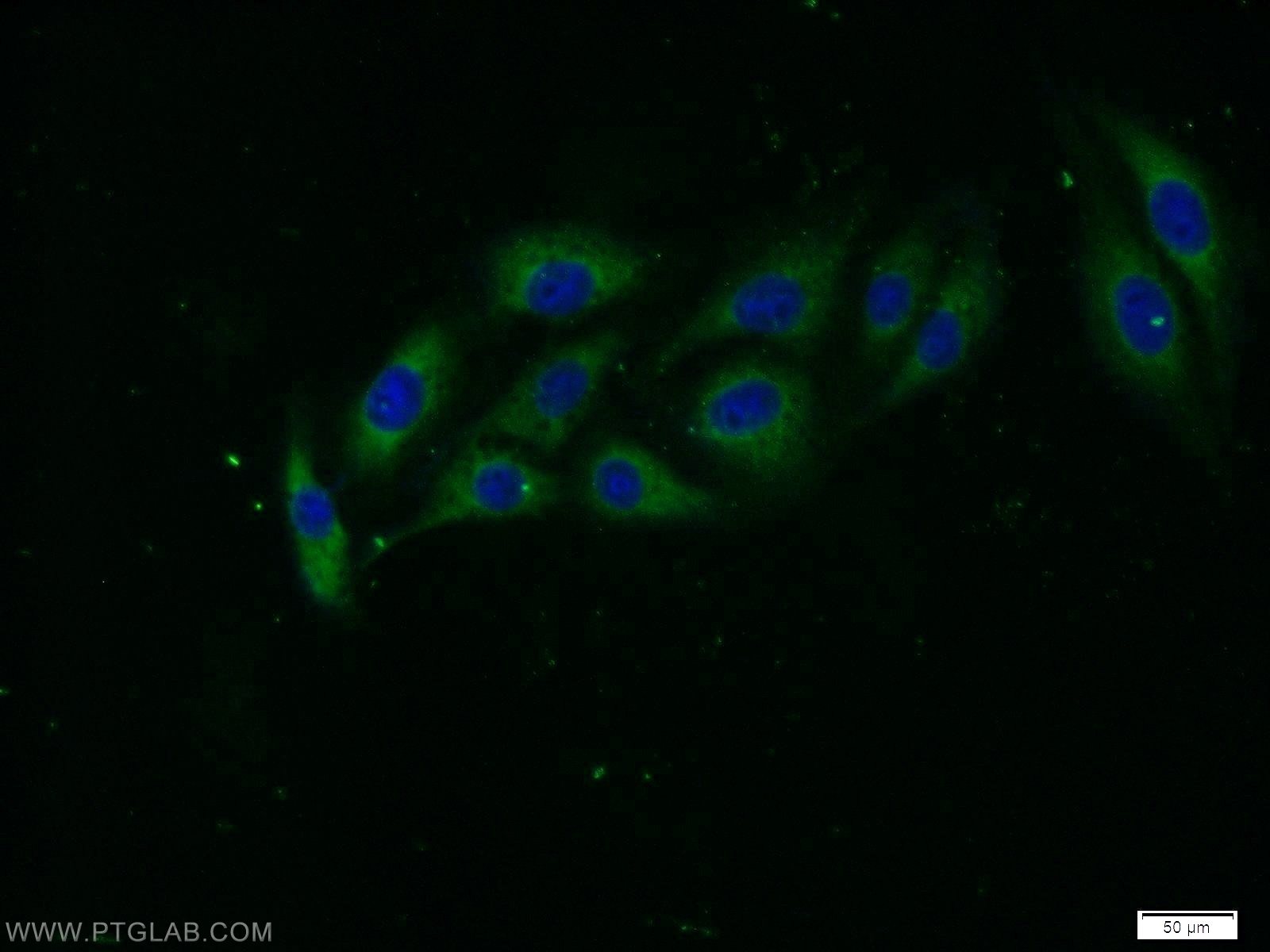 Immunofluorescence (IF) / fluorescent staining of SH-SY5Y cells using STXBP5 Polyclonal antibody (24512-1-AP)