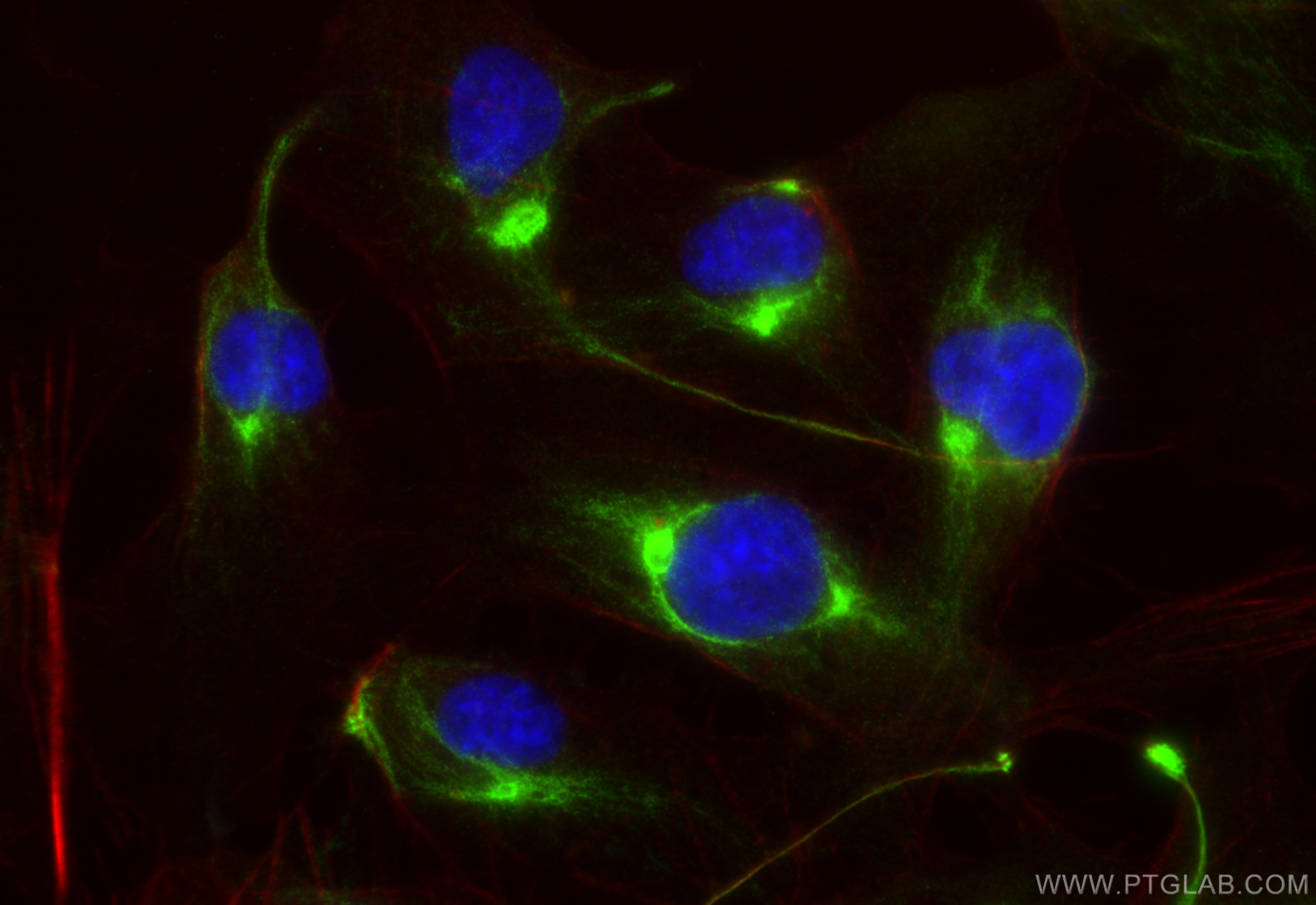 Immunofluorescence (IF) / fluorescent staining of HUVEC cells using STXBP5 Polyclonal antibody (24512-1-AP)