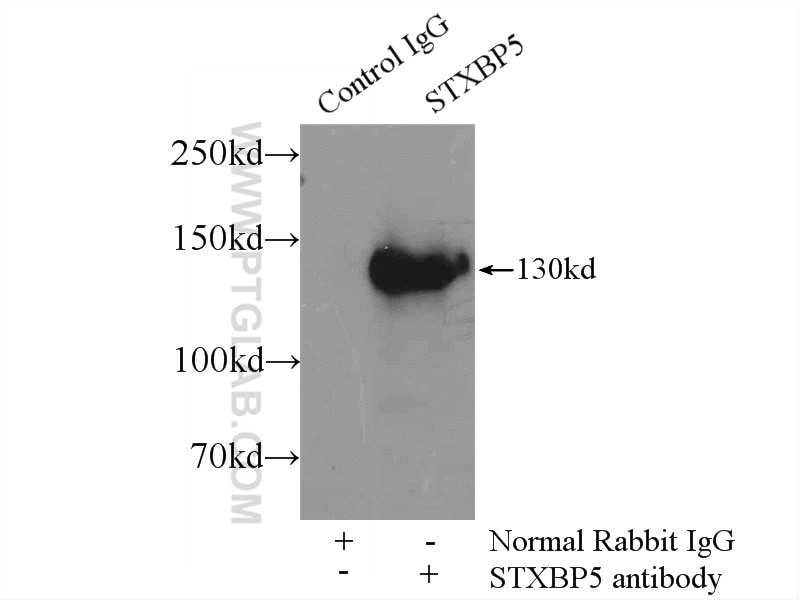 Immunoprecipitation (IP) experiment of rat brain tissue using STXBP5 Polyclonal antibody (24512-1-AP)