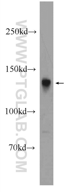 Western Blot (WB) analysis of rat brain tissue using STXBP5 Polyclonal antibody (24512-1-AP)