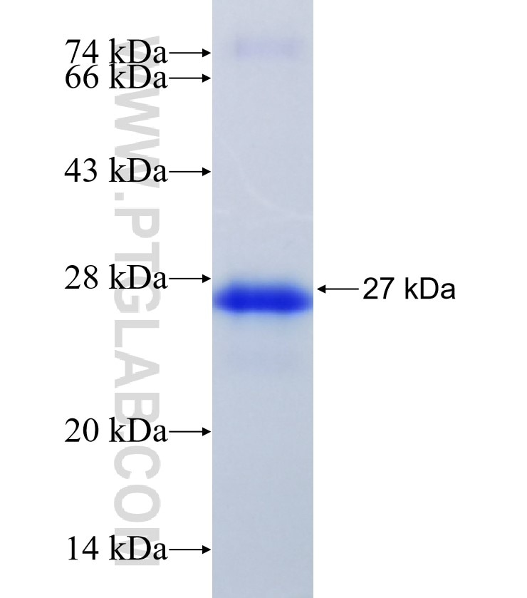 STXBP5L fusion protein Ag34104 SDS-PAGE STXBP5L fusion protein Ag34104 SDS-PAGE