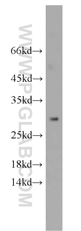 Western Blot (WB) analysis of human heart tissue using STXBP6 Polyclonal antibody (10976-4-AP)