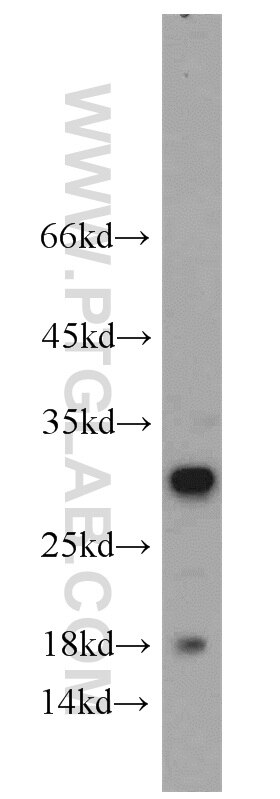 Western Blot (WB) analysis of human brain tissue using STXBP6 Polyclonal antibody (10976-4-AP)