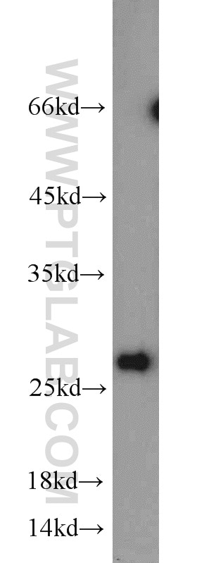 Western Blot (WB) analysis of mouse brain tissue using STXBP6 Polyclonal antibody (10976-4-AP)