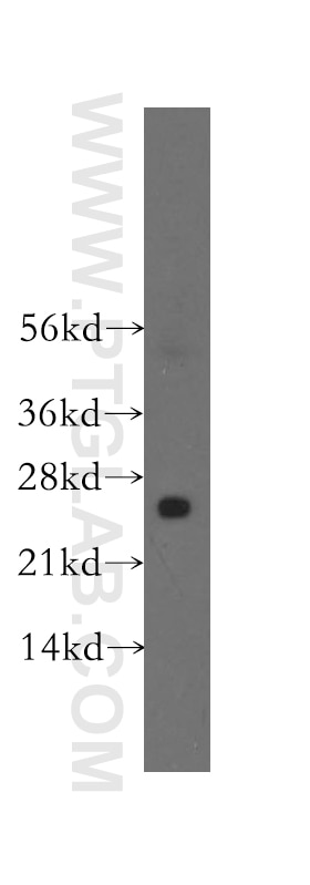 Western Blot (WB) analysis of human heart tissue using STXBP6 Polyclonal antibody (10976-4-AP)
