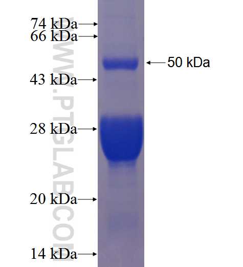 STXBP6 fusion protein Ag1427 SDS-PAGE
