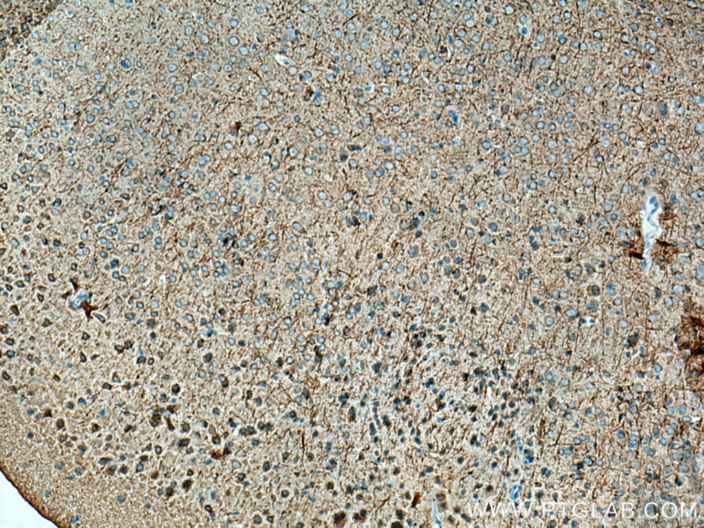 Immunohistochemistry (IHC) staining of mouse brain tissue using STYK1 Polyclonal antibody (18028-1-AP)