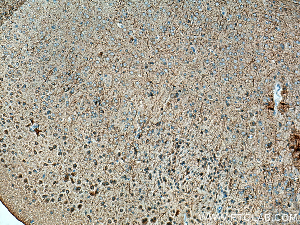 Immunohistochemistry (IHC) staining of mouse brain tissue using STYK1 Polyclonal antibody (18028-1-AP)