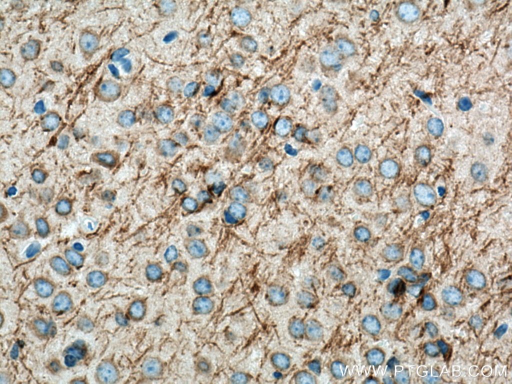 Immunohistochemistry (IHC) staining of mouse brain tissue using STYK1 Polyclonal antibody (18028-1-AP)