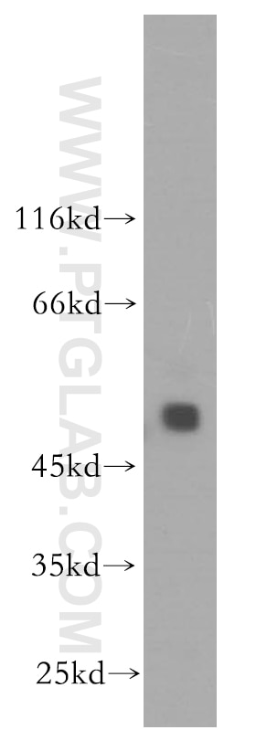 Western Blot (WB) analysis of human brain tissue using STYK1 Polyclonal antibody (18028-1-AP)