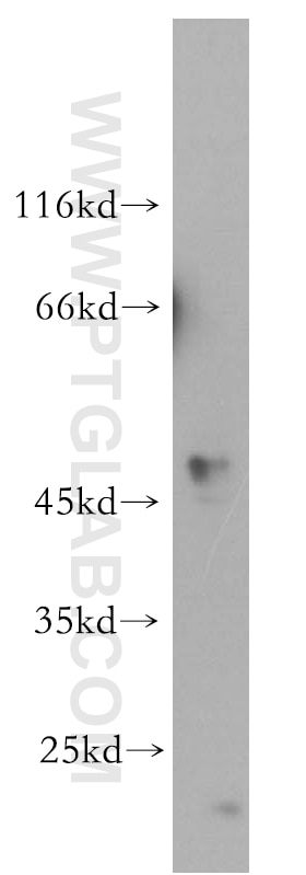 Western Blot (WB) analysis of HeLa cells using STYK1 Polyclonal antibody (18028-1-AP)