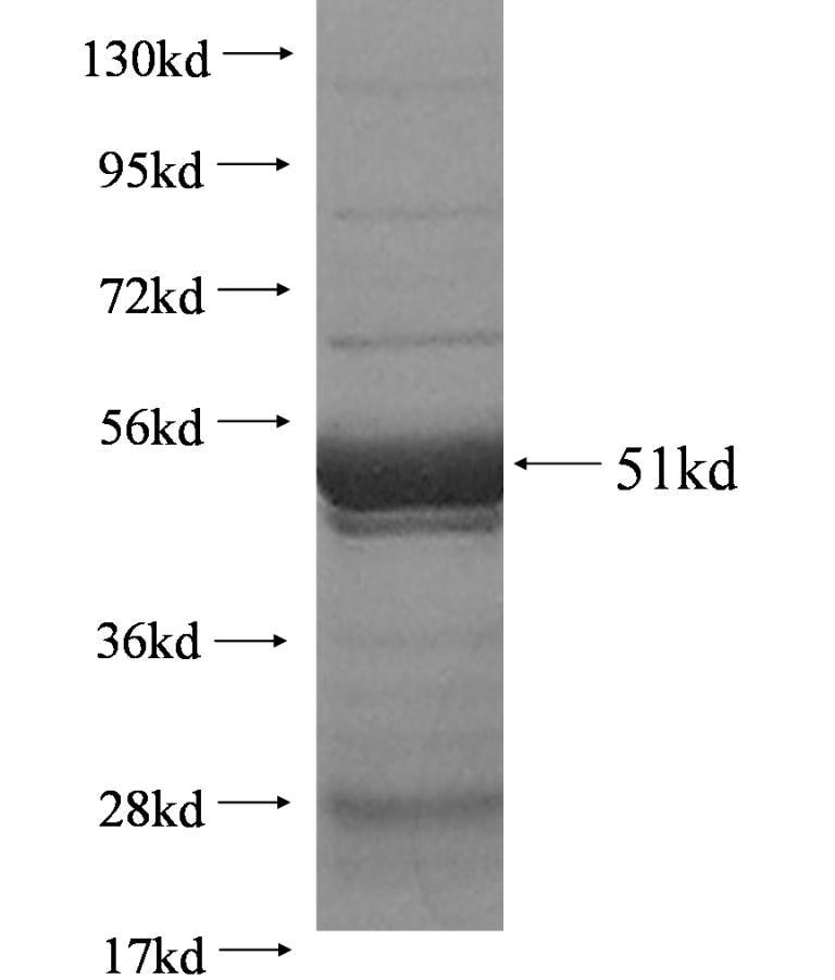STYX fusion protein Ag2878 SDS-PAGE