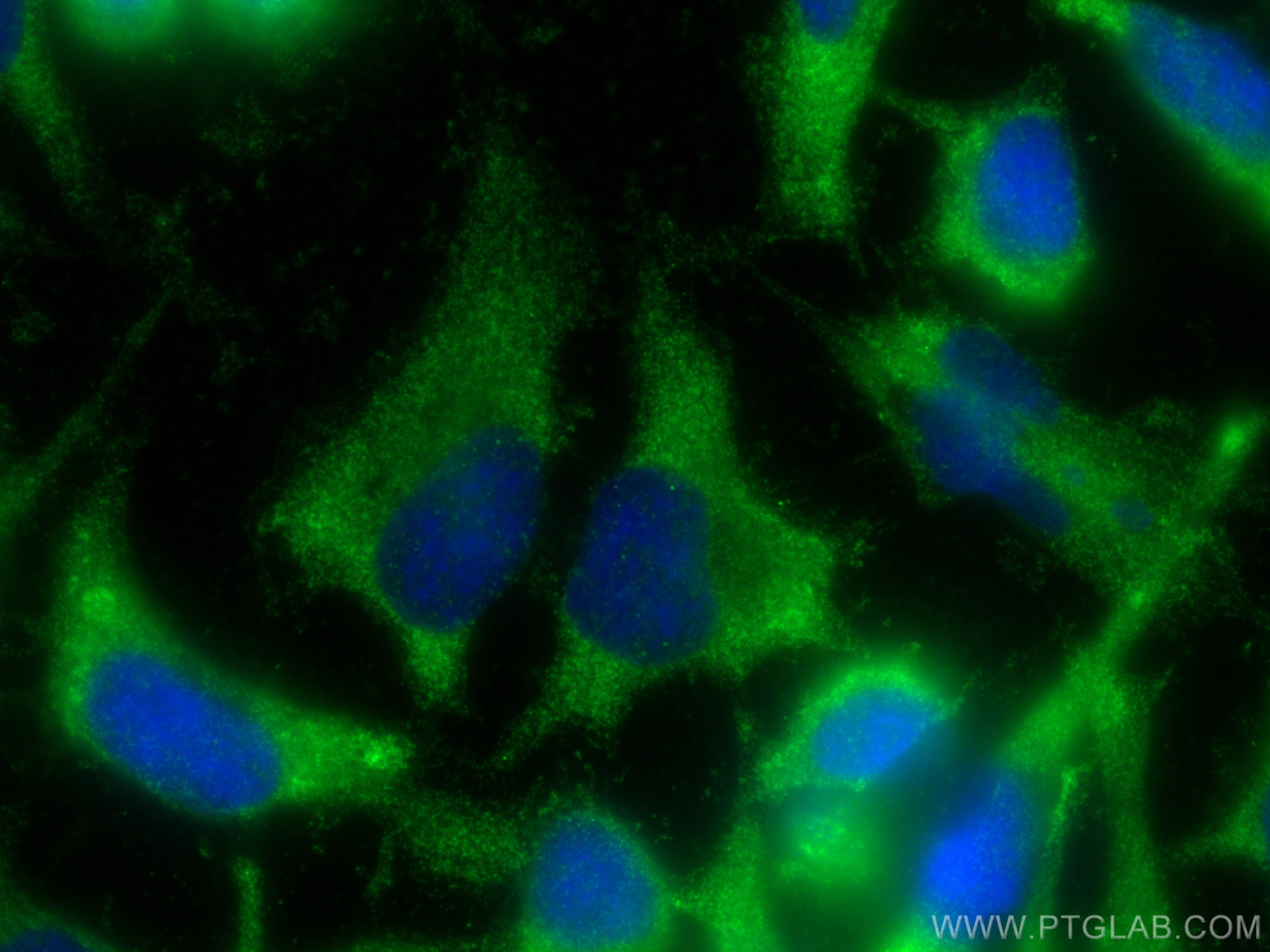 Immunofluorescence (IF) / fluorescent staining of HeLa cells using STYXL1 Polyclonal antibody (16433-1-AP)