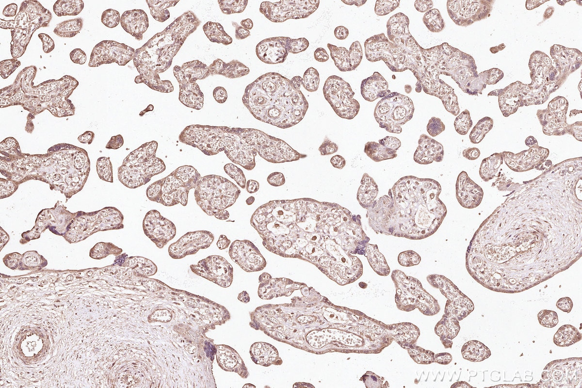 IHC staining of human placenta using 16433-1-AP Immunohistochemistry (IHC) staining of human placenta tissue using STYXL1 Polyclonal antibody (16433-1-AP)